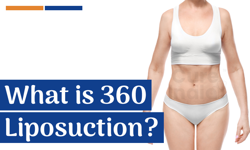What is 360 Liposuction as Compared to Abdominal Liposuction?